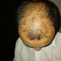 發(fā)際線用戶圖片