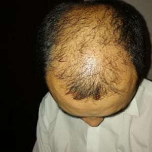 发际线分享社区
