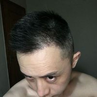 發(fā)際線用戶圖片