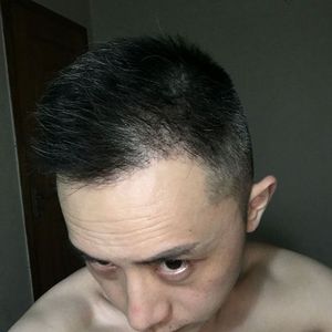 发际线分享社区