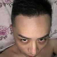 發(fā)際線用戶圖片