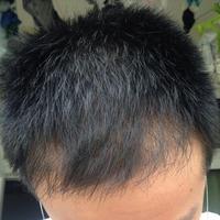 發(fā)際線用戶圖片