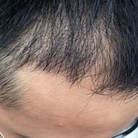 發(fā)際線用戶圖片