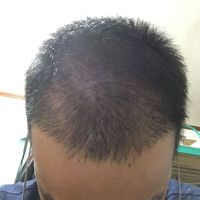 發(fā)際線用戶圖片