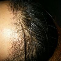 發(fā)際線用戶圖片