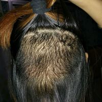 發(fā)際線用戶圖片