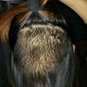 发际线分享社区