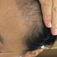 發(fā)際線用戶圖片