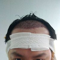 發(fā)際線用戶圖片