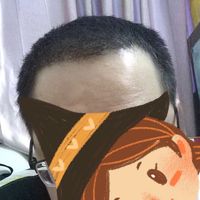 發(fā)際線用戶圖片
