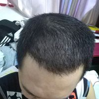 發(fā)際線用戶圖片