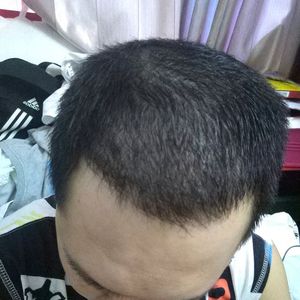 发际线分享社区