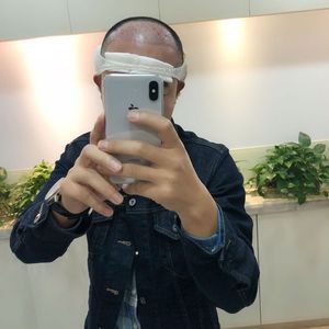发际线分享社区