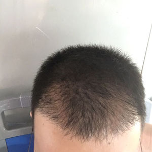 发际线分享社区