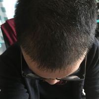 發(fā)際線用戶圖片