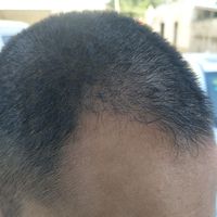 發(fā)際線用戶圖片