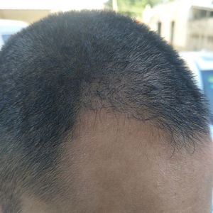 发际线分享社区