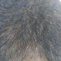 發(fā)際線用戶圖片
