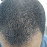 發(fā)際線用戶圖片