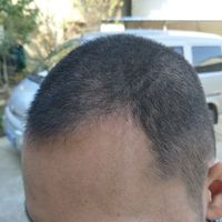 發(fā)際線用戶圖片