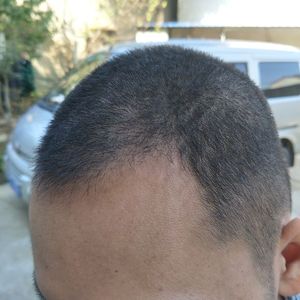 发际线分享社区
