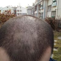 發(fā)際線用戶圖片