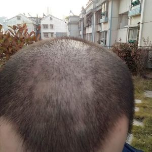 发际线分享社区