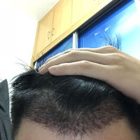 發(fā)際線用戶圖片