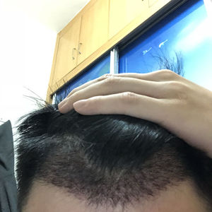发际线分享社区