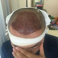 發(fā)際線用戶圖片