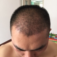 發(fā)際線用戶圖片