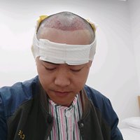 發(fā)際線用戶圖片