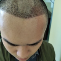 發(fā)際線用戶圖片