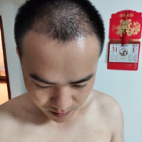 發(fā)際線(xiàn)用戶(hù)圖片