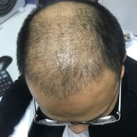 發(fā)際線(xiàn)用戶(hù)圖片