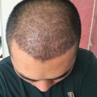發(fā)際線(xiàn)用戶(hù)圖片