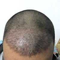 發(fā)際線(xiàn)用戶(hù)圖片