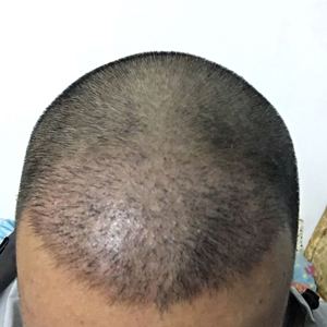 发际线分享社区