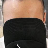 發(fā)際線用戶圖片