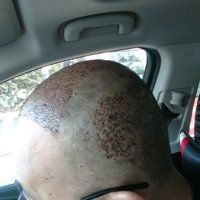 發(fā)際線用戶圖片