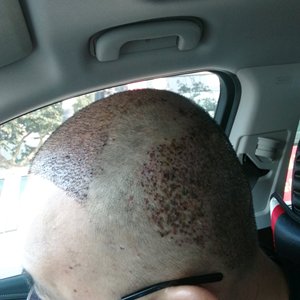 发际线分享社区