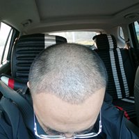 發(fā)際線用戶圖片