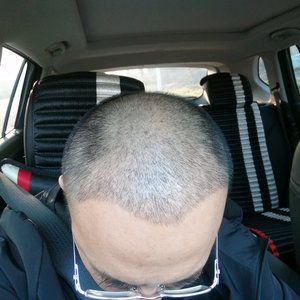 发际线分享社区