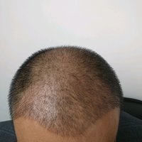 發(fā)際線用戶圖片