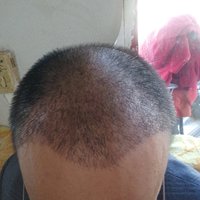 發(fā)際線用戶圖片