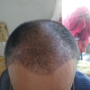 发际线分享社区