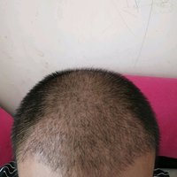 發(fā)際線用戶圖片
