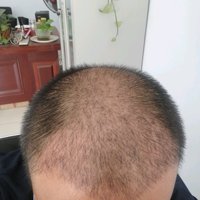 發(fā)際線用戶圖片