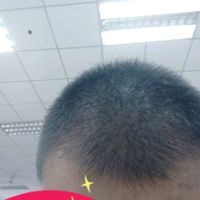發(fā)際線用戶圖片