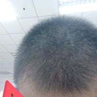 發(fā)際線用戶圖片